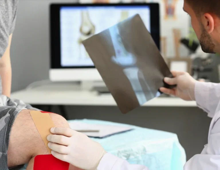 Doctor examines patient knee, going over the x-ray taken of the patient with the goal of repairing the knee with PEMFs